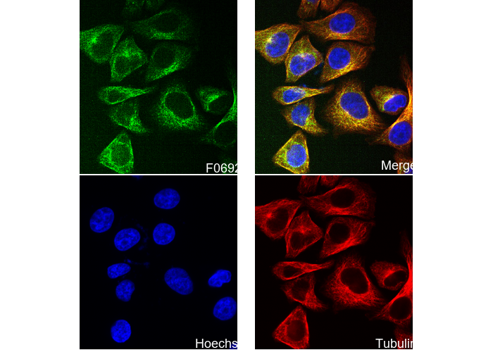 MYPT1 Antibody