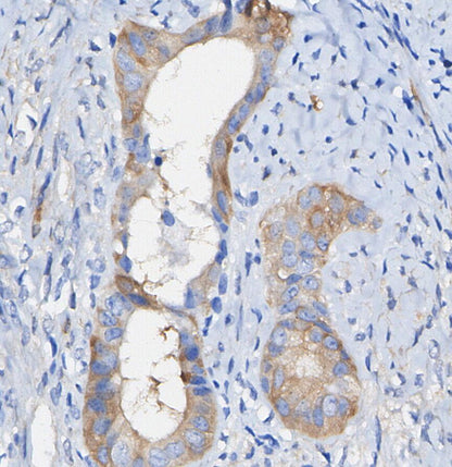 Neurofilament-M Antibody