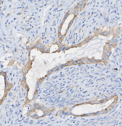 Phospho-PLCγ1 (Ser1248) Antibody
