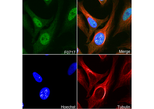 hnRNP A1 Antibody