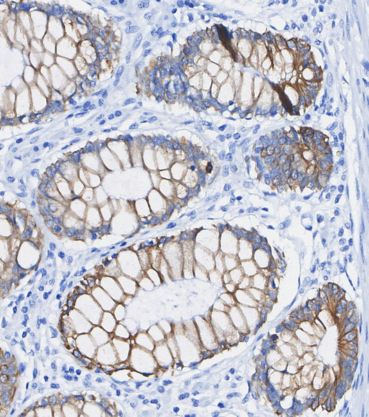 ABCG2 Antibody