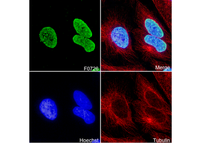 Histone H3 (di/tri methyl Lys9) Antibody