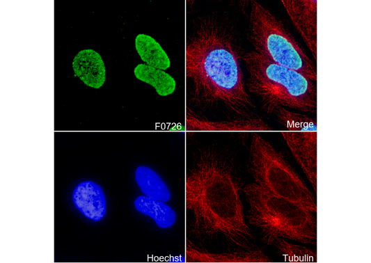 Histone H3 (di/tri methyl Lys9) Antibody