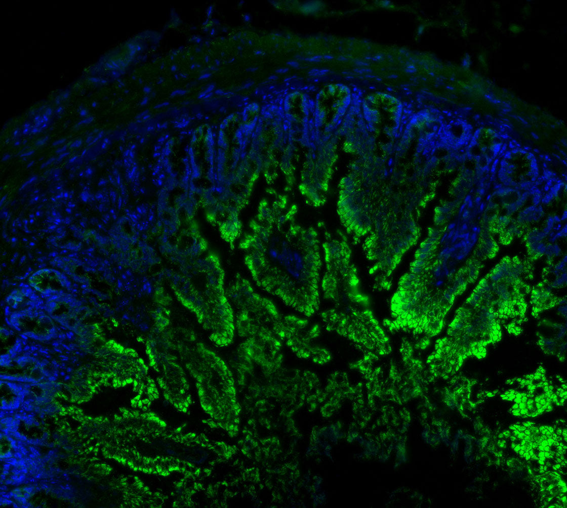 MCU Antibody