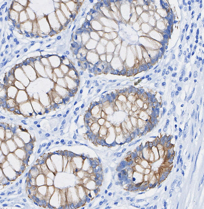 NDRG1 Antibody