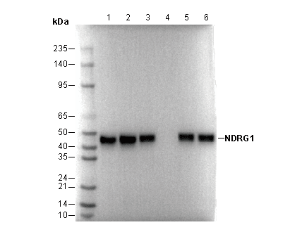 NDRG1 Antibody