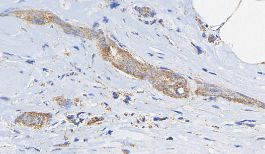 PAI-1 Antibody