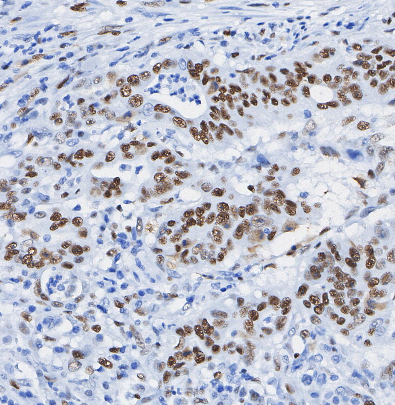 Vitamin D3 Receptor Antibody