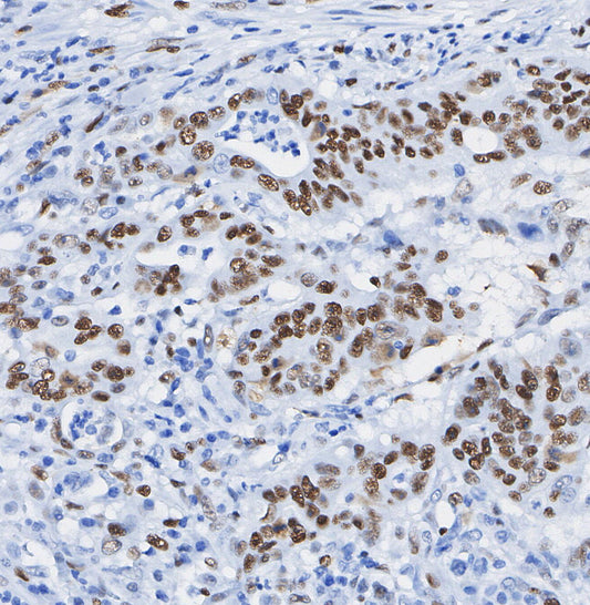 Vitamin D3 Receptor Antibody