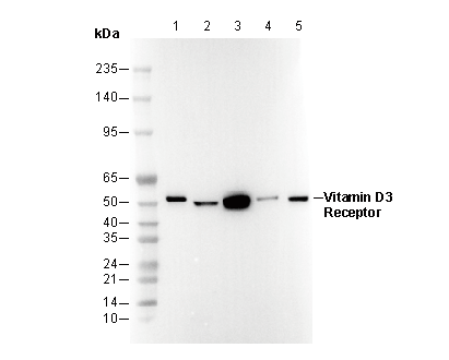 Vitamin D3 Receptor Antibody