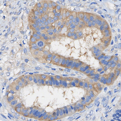 RKIP Antibody