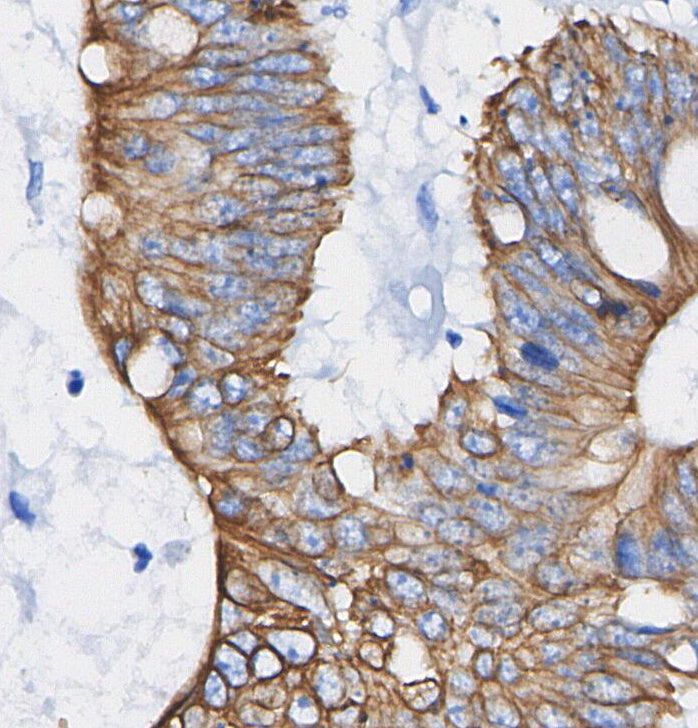 Pan Cadherin Antibody