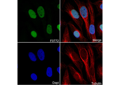 ASF1A Antibody