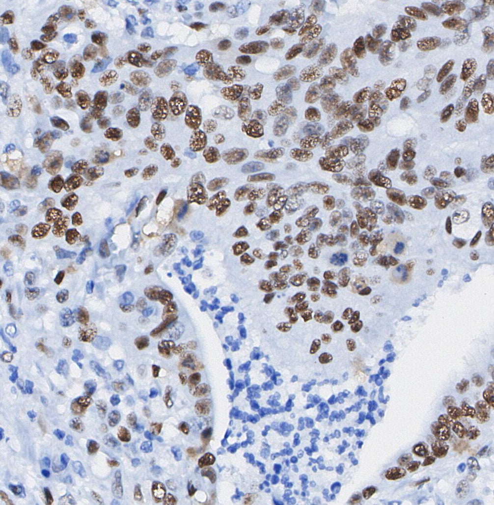 ASF1A Antibody