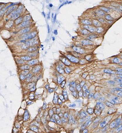 CEA/CD66e Antibody
