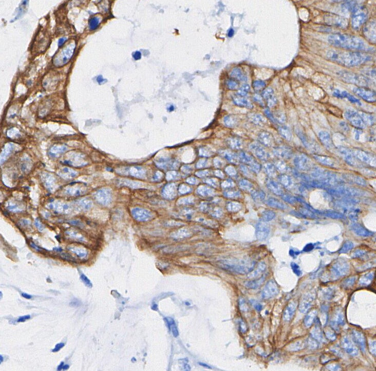 FGF Receptor 2 Antibody