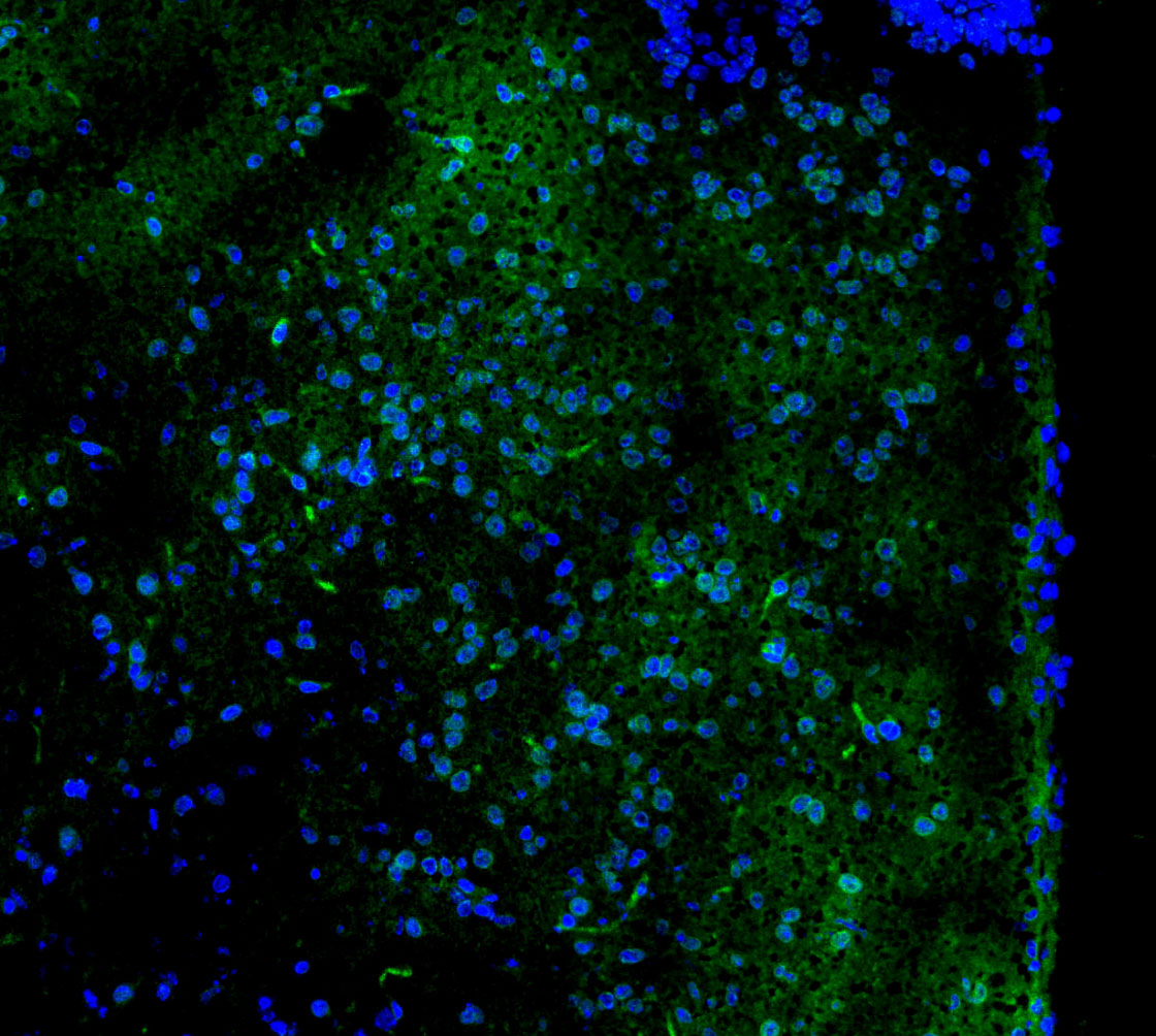 GAD2 Antibody