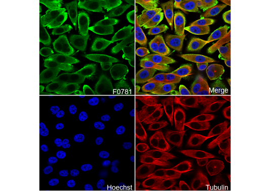 GSTP1 Antibody