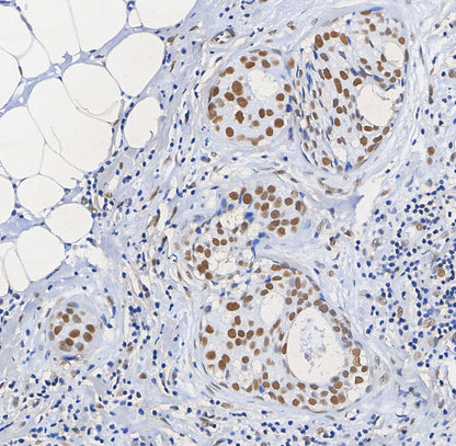 Histone H2B Antibody
