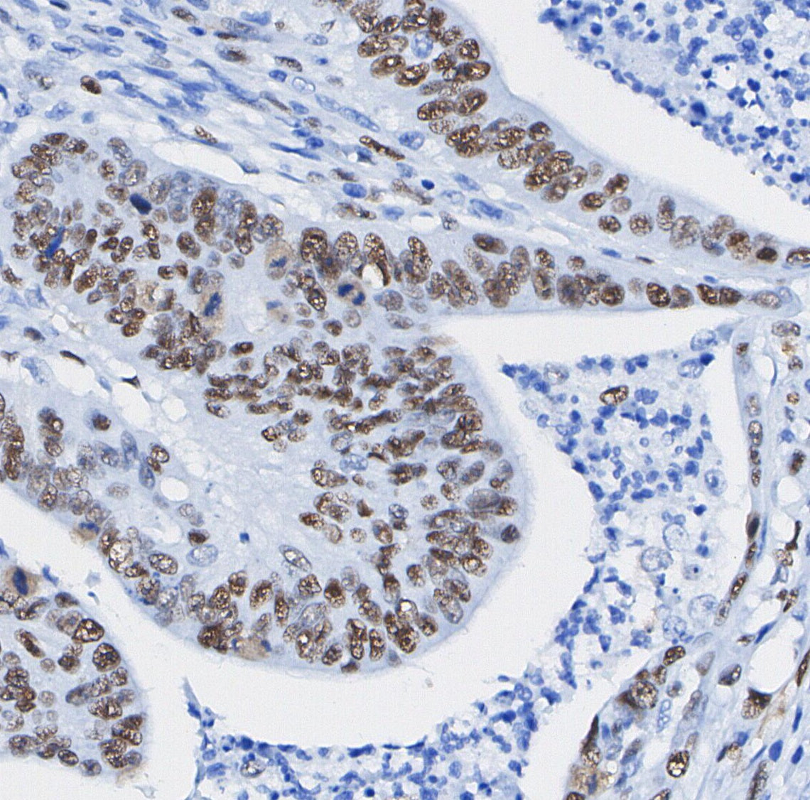 MTA1 Antibody