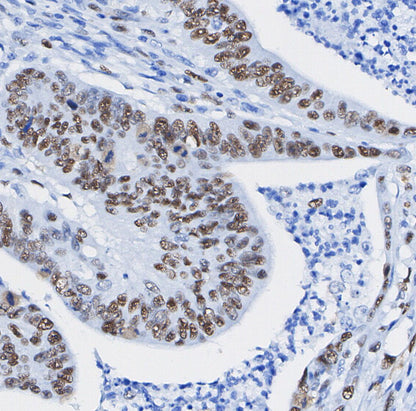 MTA1 Antibody