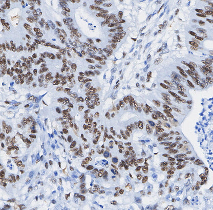 Nucleolin Antibody