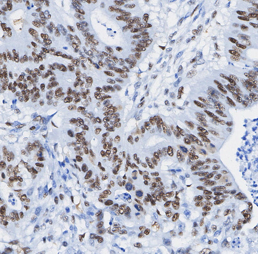Nucleolin Antibody