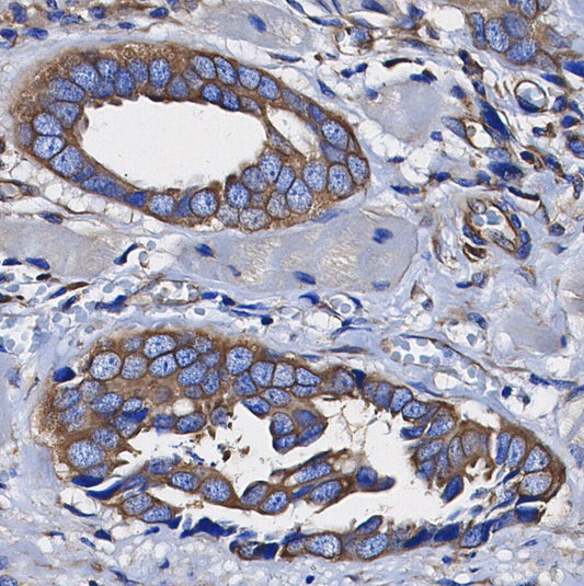 PP2A B Subunit Antibody