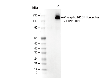 Phospho-PDGF Receptor β (Tyr1009) Antibody