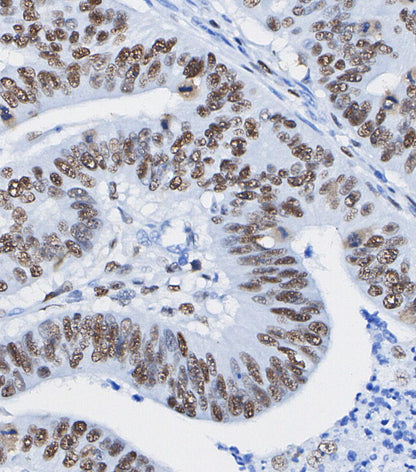 Progesterone Receptor B Antibody