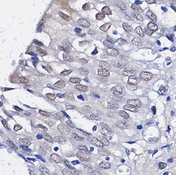 RSK2 Antibody
