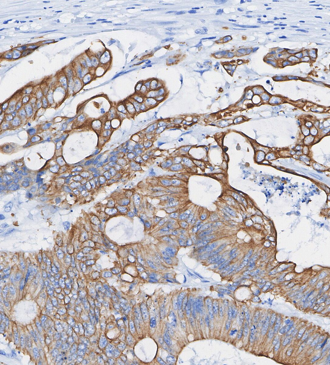 MRP1/ABCC1 Antibody