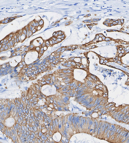 MRP1/ABCC1 Antibody