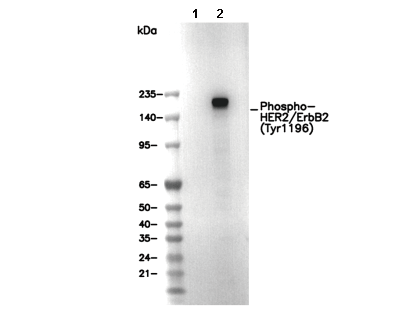 Phospho-HER2/ErbB2 (Tyr1196) Antibody