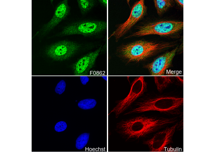 TIAR Antibody