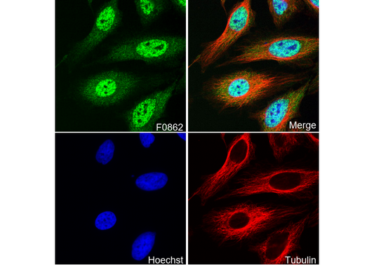 TIAR Antibody