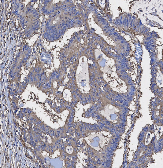 Thymidylate Synthase Antibody