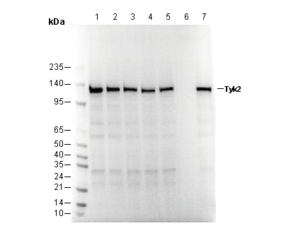Tyk2 Antibody