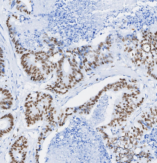 UTX Antibody