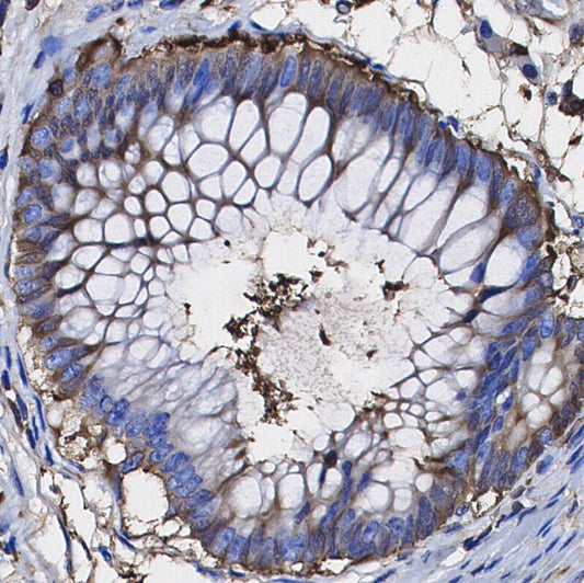 C1QBP Antibody