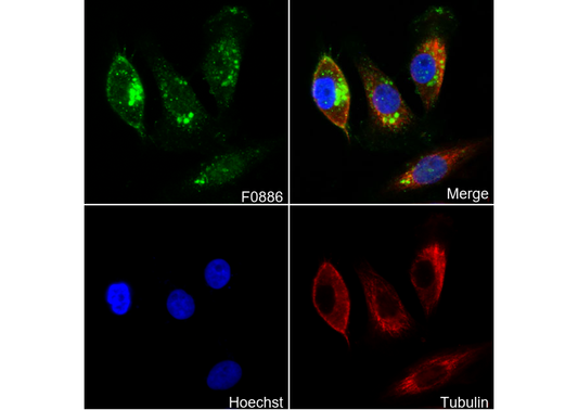 Fibronectin/FN1 Antibody