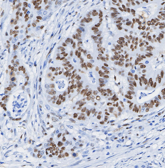 FoxP1 Antibody