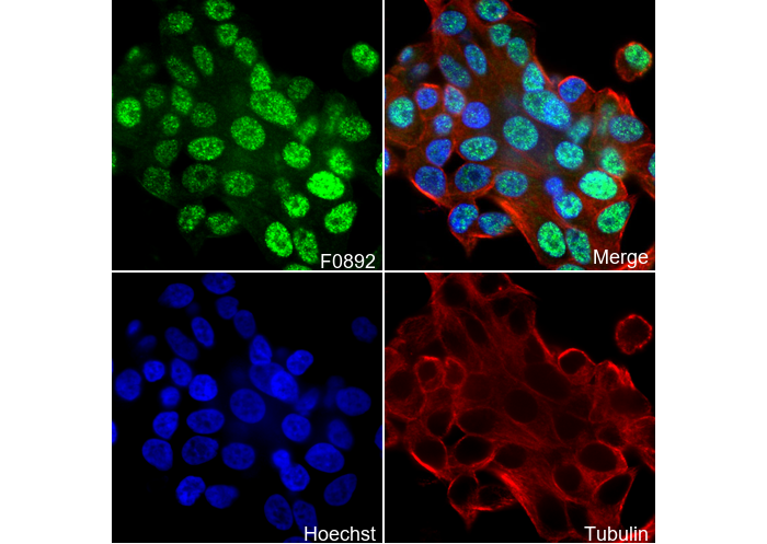 JMJD2B Antibody