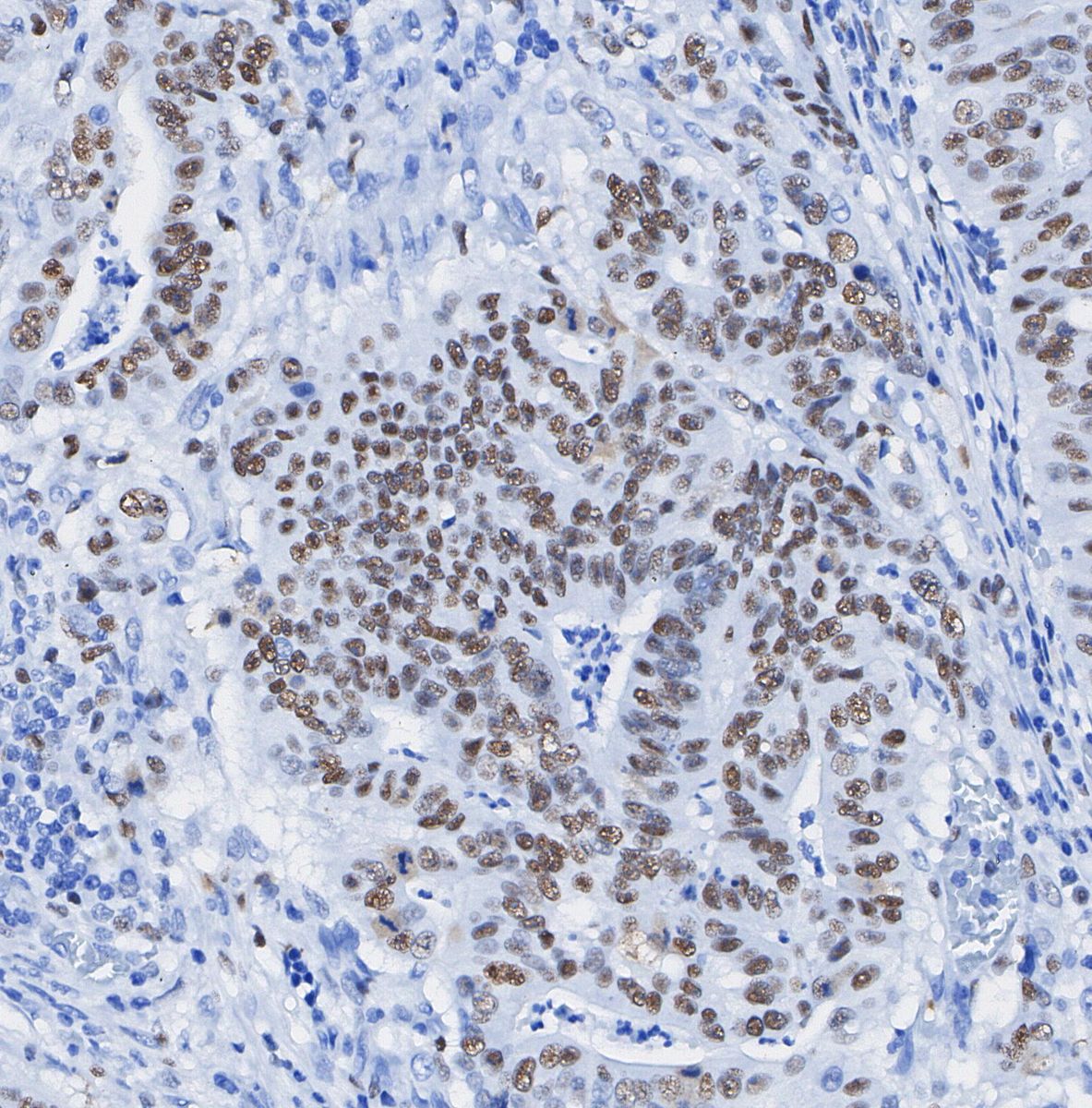N-Myc Antibody