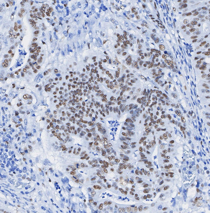 N-Myc Antibody