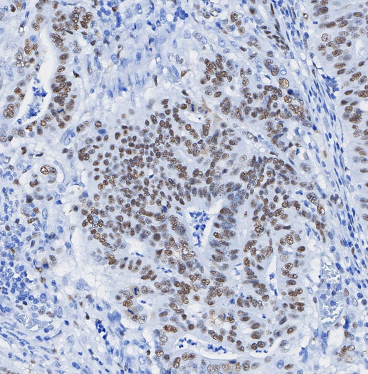 N-Myc Antibody