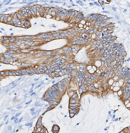 PKCθ Antibody