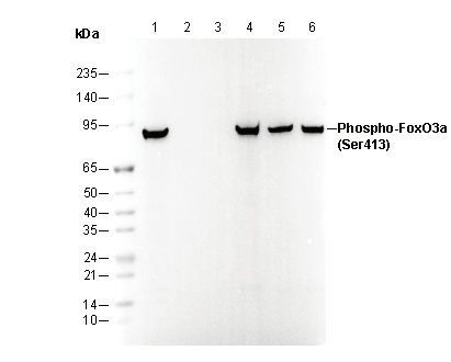 Phospho-FoxO3a (Ser413) Antibody
