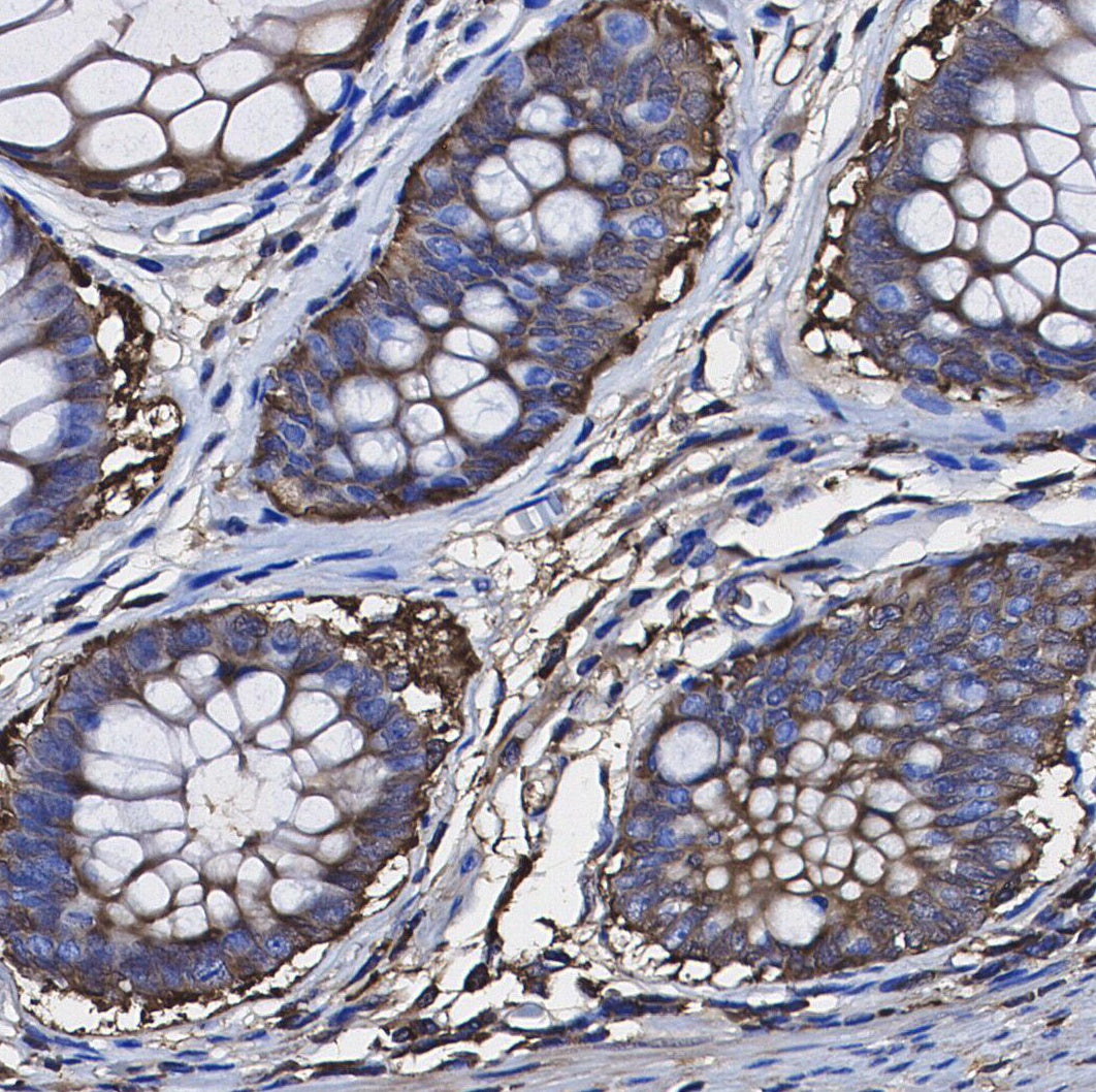 RRM1 Antibody