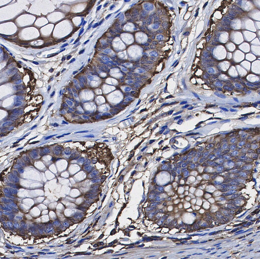 RRM1 Antibody